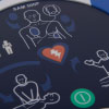 A close-up of the defibrillator screen and buttons